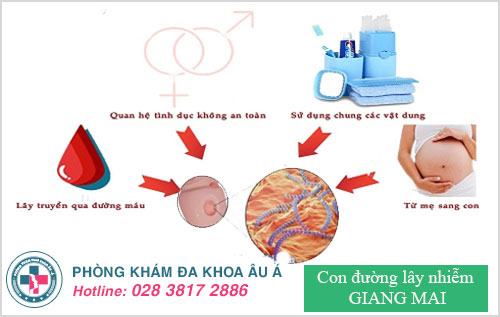Bệnh giang mai lây truyền qua con đường nào? Bệnh giang mai lây truyền qua con đường nào?