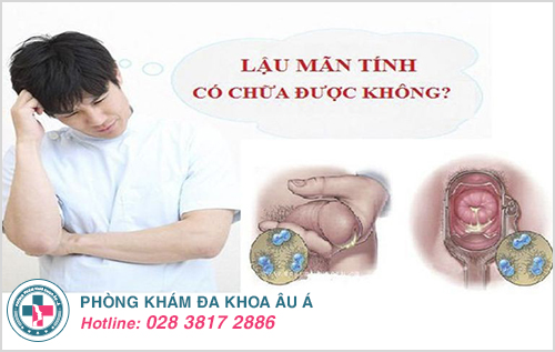 Bệnh lậu mãn tính có chữa được không? Bệnh lậu mãn tính có chữa được không?