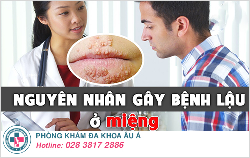 Nguyên nhân gây bệnh lậu ở miệng Nguyên nhân gây bệnh lậu ở miệng