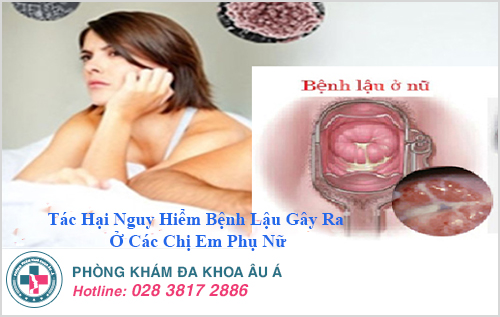 Biến chứng nguy hại từ bệnh lậu đối với nữ giới Biến chứng nguy hại từ bệnh lậu đối với nữ giới