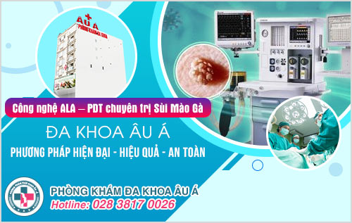 Ảnh sùi mào gà giai đoạn đầu