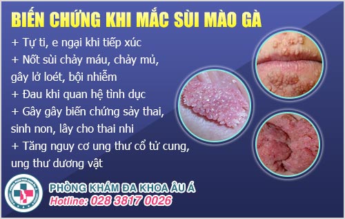 Bị sùi mào gà có ngứa không