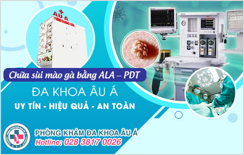 Bị sùi mào gà có ngứa không