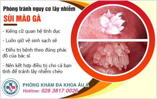 Bị sùi mào gà có quan hệ được không