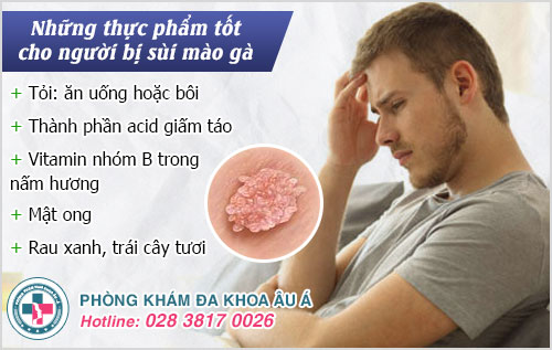 Bị sùi mào gà kiêng ăn gì