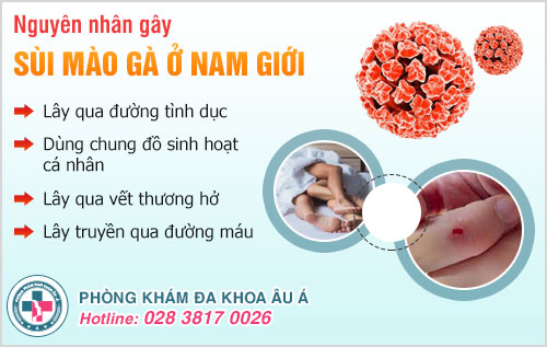 nguyên nhân gây sùi mào gà ở nam giới