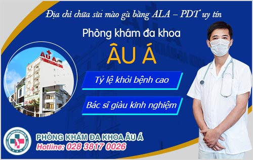 phương pháp ALA - PDT có tốt không