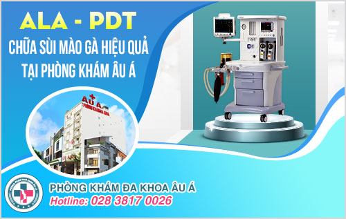 Sùi mào gà có nguy hiểm không