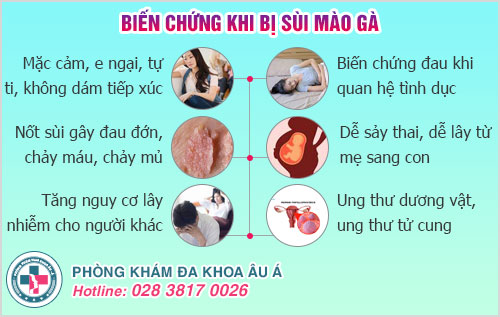 Sùi mào gà lây qua đường nào