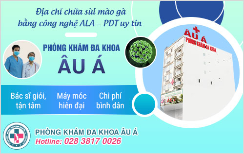 sùi mào gà ở môi