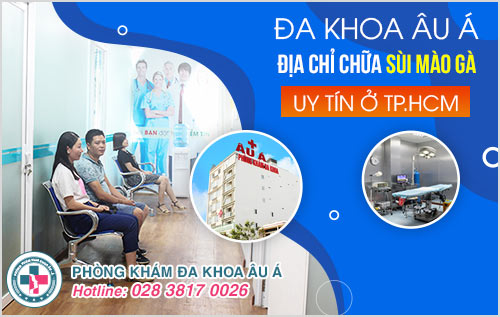 sùi mào gà ở nữ
