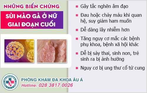 sùi mào gà ở nữ giai đoạn cuối