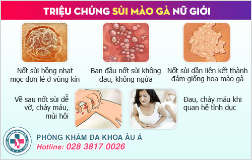 Tại sao bị sùi mào gà ở nữ
