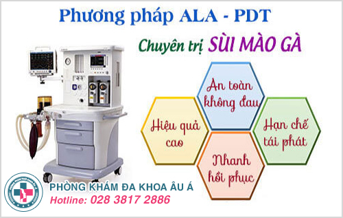 Phương Pháp ALA-PDT Cách Điều Trị Sùi Mào Gà An Toàn Ở Nam Và Nữ Giới Phương Pháp ALA-PDT Cách Điều Trị Sùi Mào Gà An Toàn Ở Nam Và Nữ Giới.