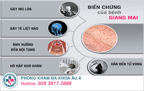 Mức Độ Nguy Hiểm Của Bệnh Giang Mai Mức Độ Nguy Hiểm Của Bệnh Giang Mai