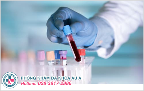 Xét Nghiệm Bệnh Giang Mai Bao Lâu Chính Xác? Xét Nghiệm Bệnh Giang Mai Bao Lâu Chính Xác?